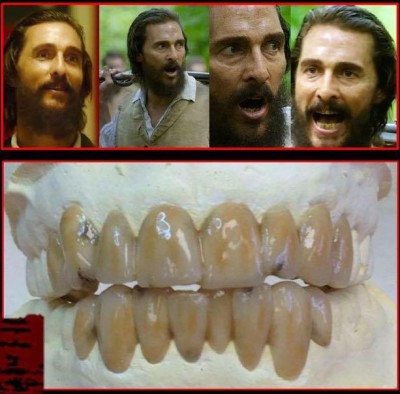 Gary Archer veneers 4.jpg