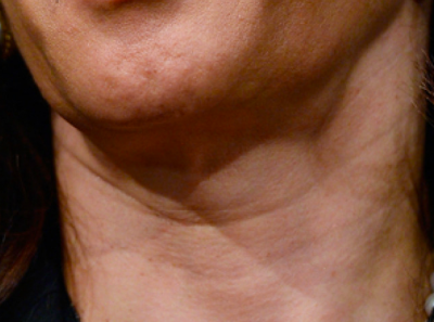 Kamala Harris's odd neck and jaw line