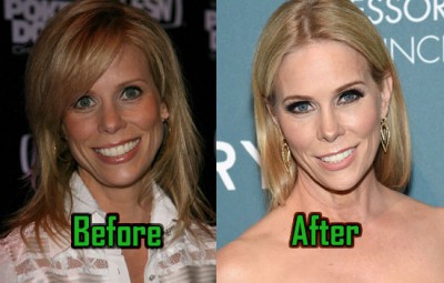 Cheryl-Hines-Plastic-Surgery.jpg